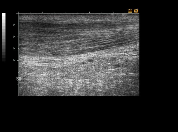 9p av Catherine Olsson, sonograf